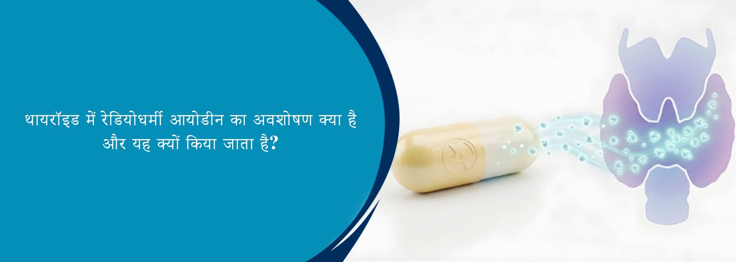 थायरॉइड में रेडियोधर्मी आयोडीन का अवशोषण क्या है और यह क्यों किया जाता है?
