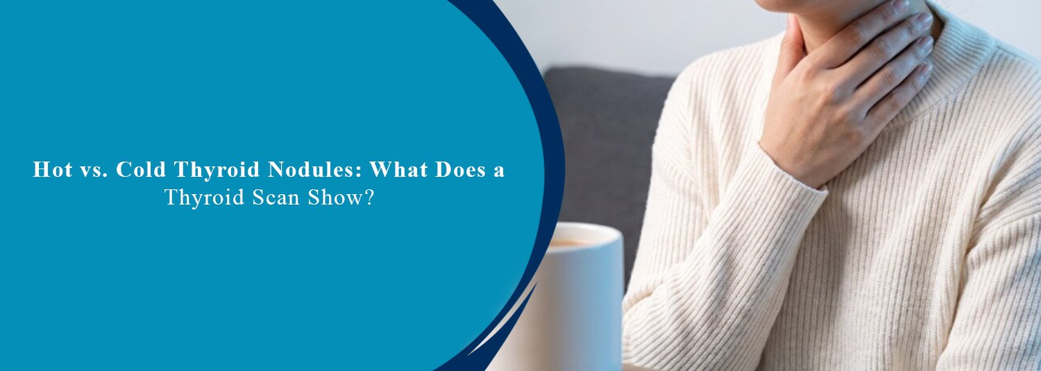 Hot vs. Cold Thyroid Nodules: What Does a Thyroid Scan Show?