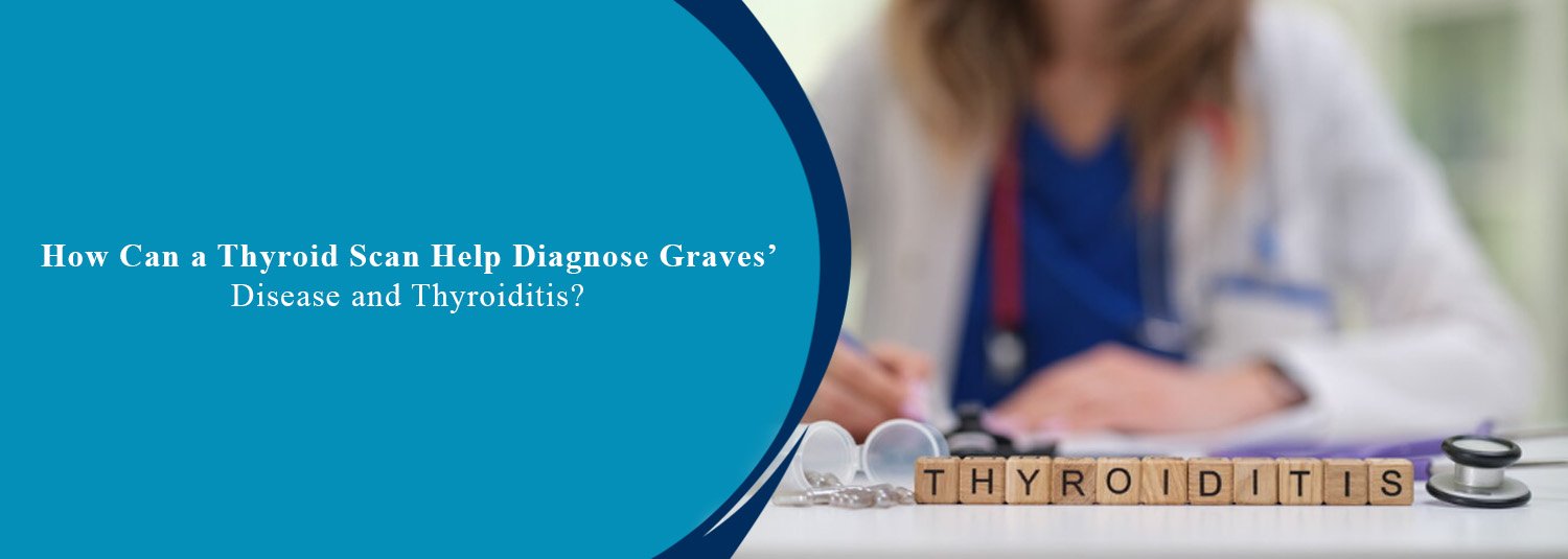 How Can a Thyroid Scan Help Diagnose Graves’ Disease and Thyroiditis?