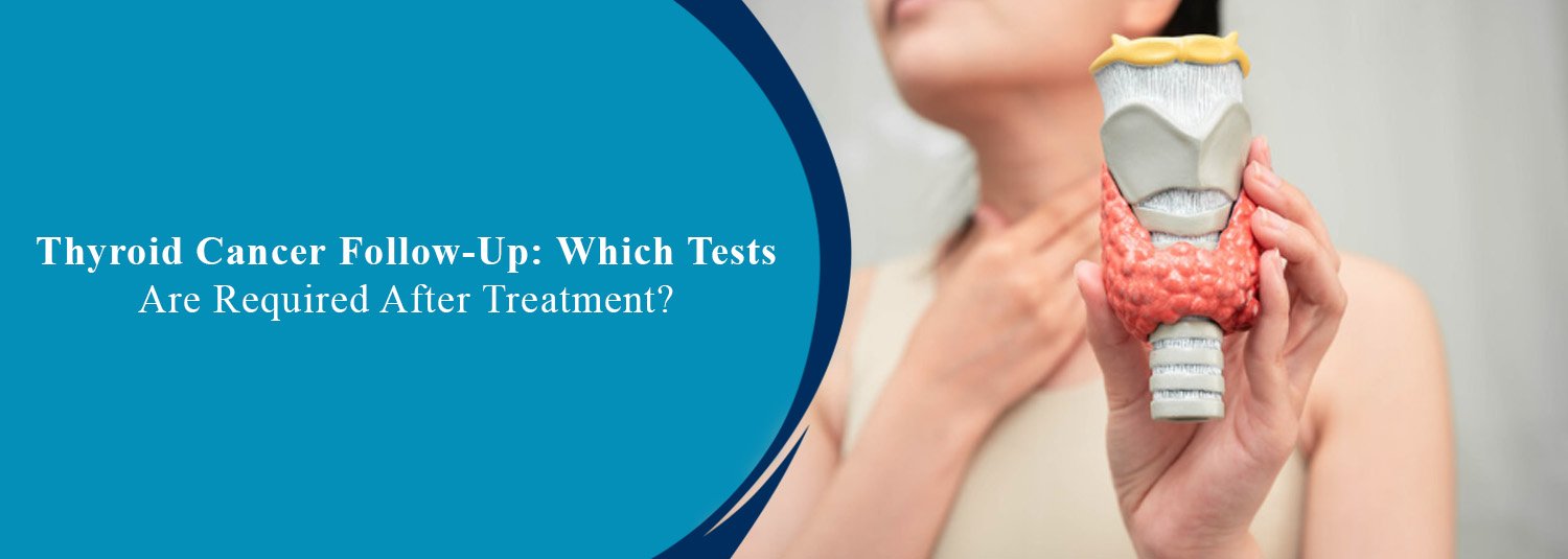 Thyroid Cancer Follow-Up: Which Tests Are Required After Treatment?