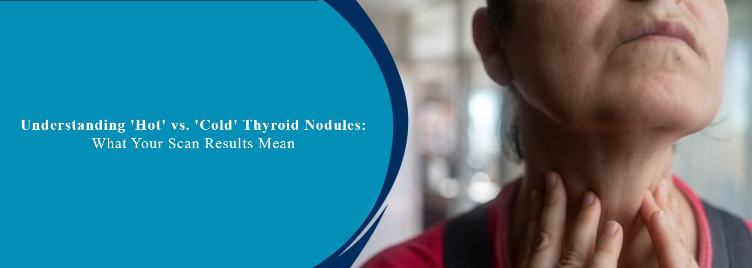 Understanding 'Hot' vs. 'Cold' Thyroid Nodules: What Your Scan Results Mean