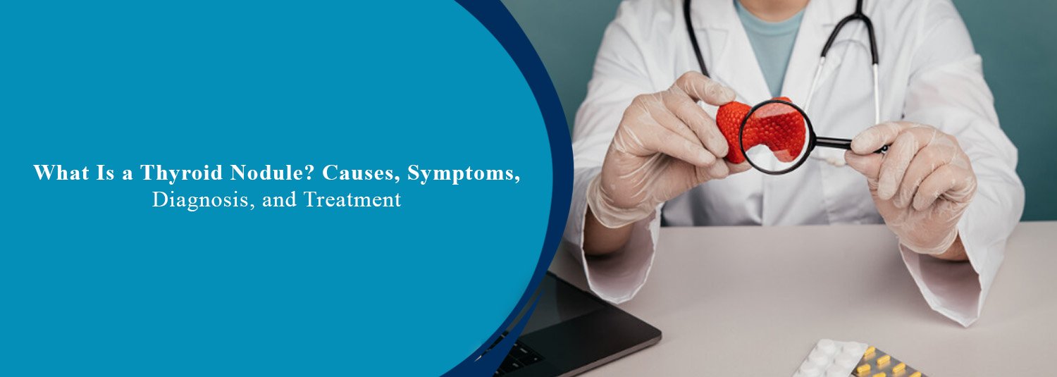 What Is a Thyroid Nodule? Causes, Symptoms, Diagnosis, and Treatment