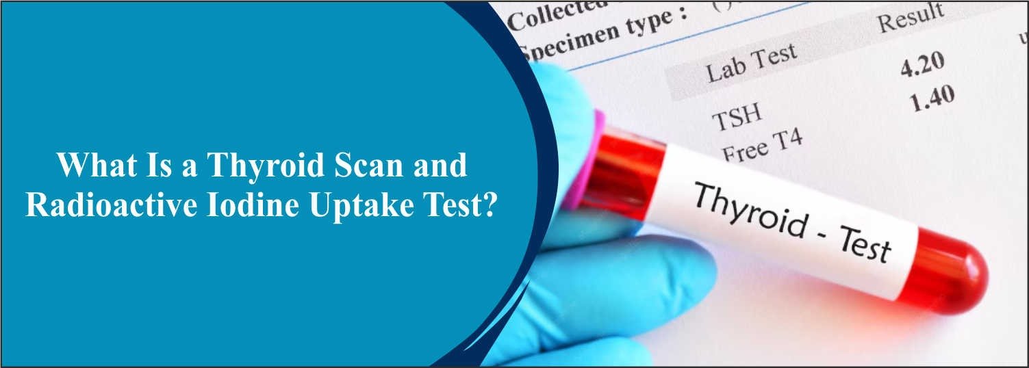 What Is a Thyroid Scan and Radioactive Iodine Uptake Test?